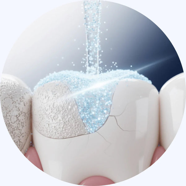 Week 4: Cavities Begin to Reverse