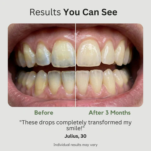 Feature product image